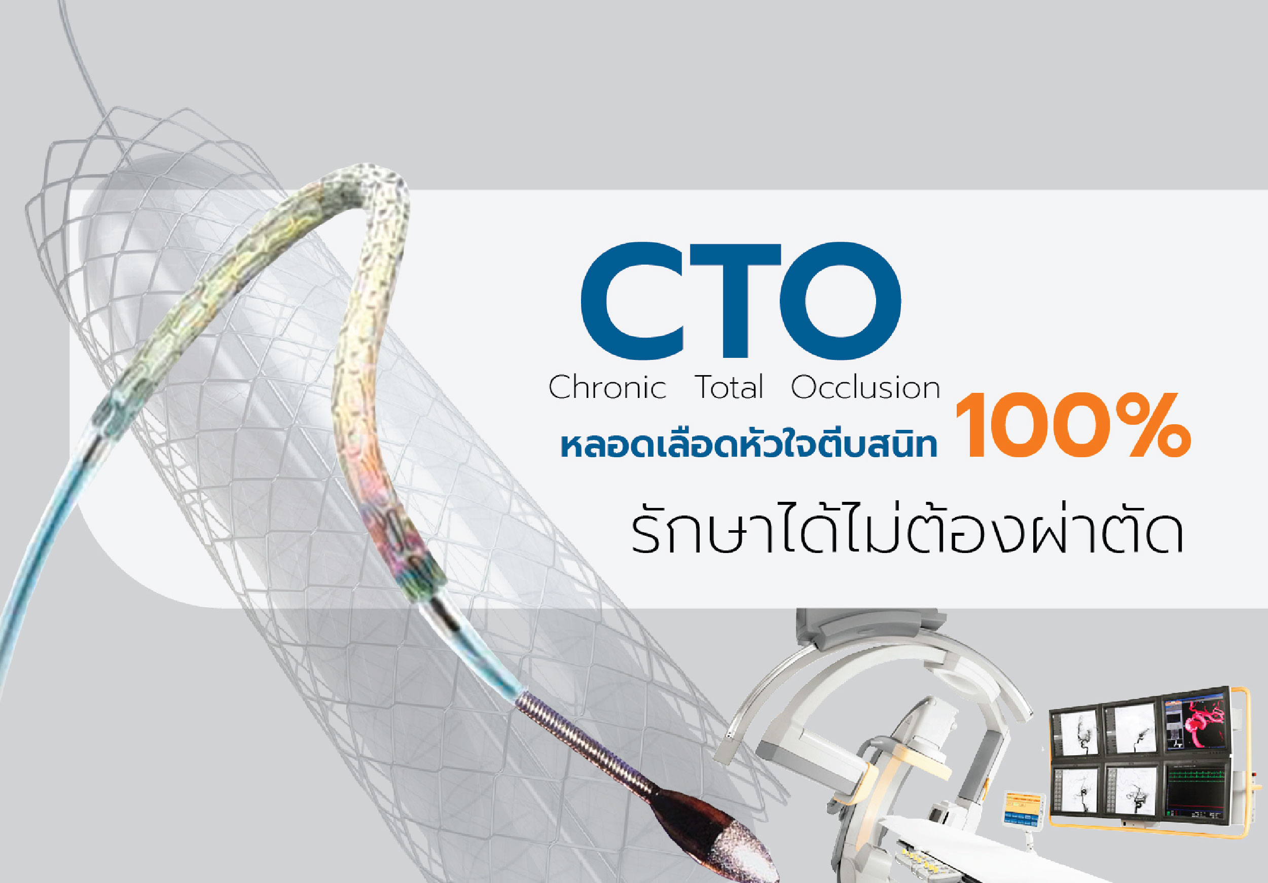 หลอดเลือดหัวใจตีบตัน 100% (Chronic total occlusion, CTO) รักษาได้โดยไม่ต้องผ่าตัด