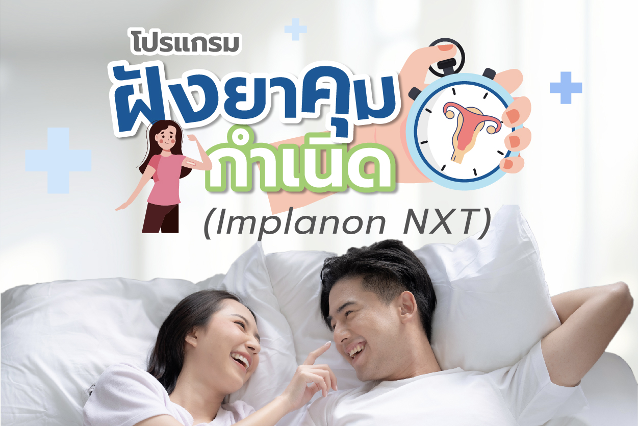 โปรแกรมฝังยาคุมกำเนิด